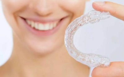 Maintaining Your New Smile: Retention After Braces
