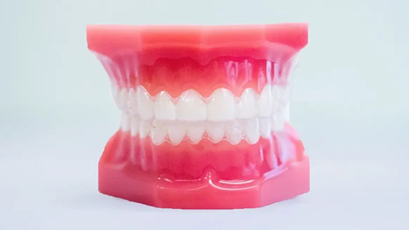 Invisalign_WeilerOrtho Invisalign WeilerOrtho